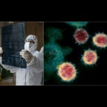 Италиански професор бие тревога: Пневмонията не е най-страшното при коронавируса! Има и други странности: