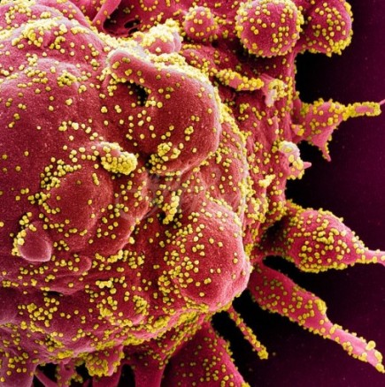 Учени откриха в естествена среда вирус, подобен на коронавируса