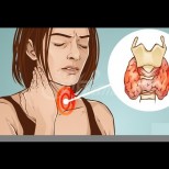 4 продукта, които унищожават щитовидната ви жлеза!
