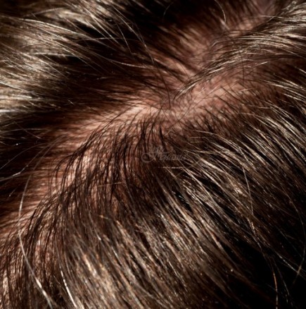 Причините за омазняване на косата без дори и да сме си помисляли, че може да са
