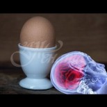 Как 1 яйце може да спаси човек от инсулт