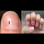 Ето за какви болести алармират белите полумесеци върху ноктите: 