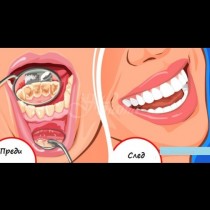 Домашна содена паста чисти зъбен камък по-добре от зъболекар - намазваш, изчакваш и сам пада! Ефикасно, без болка: