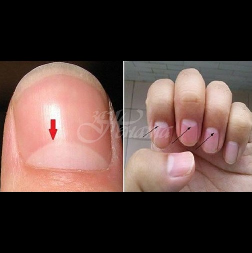 Ето за какви болести алармират белите полумесеци върху ноктите: 