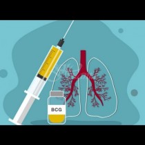 Фактите: Ето с колко пада заболеваемостта от COVID-19, ако имате БЦЖ-ваксина:
