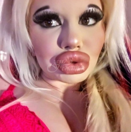 Няма да повярвате как е изглеждало българското Барби преди да си направи 21 операции на устата (снимка)