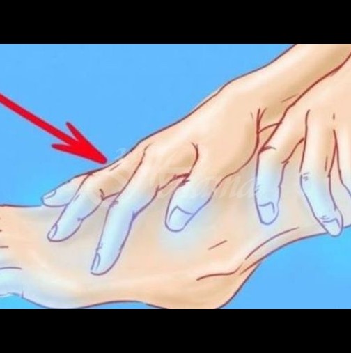 Моля, обърнете внимание: ако имате постоянно студени ръце и крака - това може да е признак на следния проблем