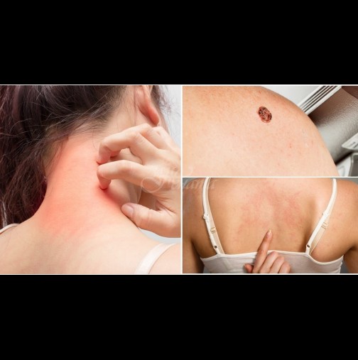 7 опасни изменения по кожата, които са първи сигнал за сериозна болест: