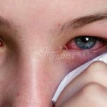Очен лекар разкри за нов симптом на COVID-19
