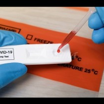 Отрицателен PCR тест при започване на работа?