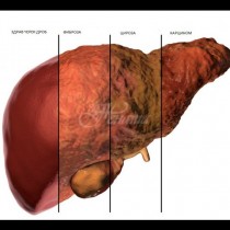 8 признака, че черният ви дроб е претоварен с токсини! Проверете се: 