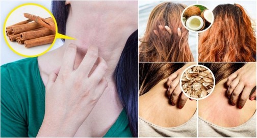 8 зловещи последици за кожата и косата от естествените средства за разкрасяване: