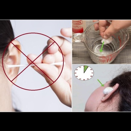 С клечка само увреждаме ухото - ето как се чисти за 5 минути, без да бъркаш вътре: