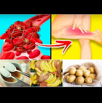 10 коварни продукта, които опасно сгъстяват кръвта и предизвикват тромби - ядем ги ежедневно:
