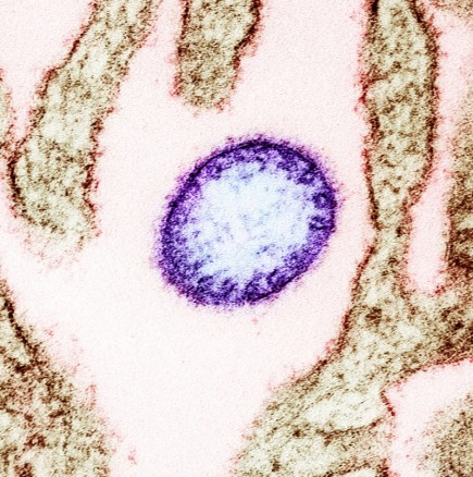 Уважавани учени предупреждават-Нов вирус причинява нова пандемия със 75 процента смъртност