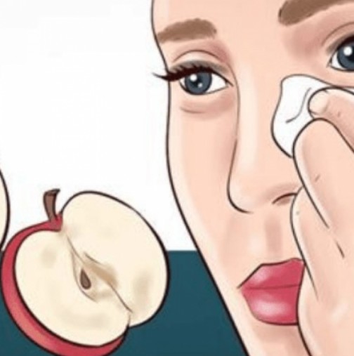 Ябълковият оцет ще ви помогне да се справите с проблемна кожа: старчески петна, акне, лунички и др.