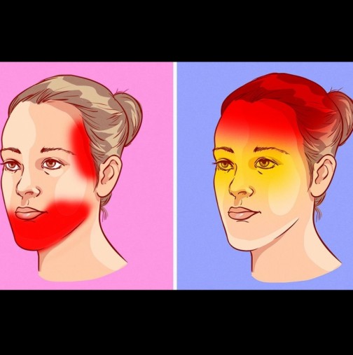 4 типа женско главоболие и как да лекуваме всеки от тях: