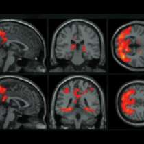 Вижте какви хормони се отделят в мозъка, при слушане на различни истории