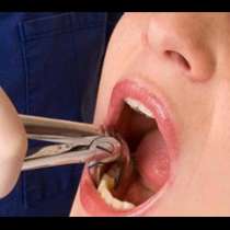 Пациентка  псува, рита и бие шамари на зъболекарка