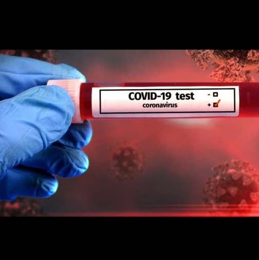 Тази кръвна група е имунизирана срещу усложнения при коронавируса: