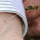 КОгато ви ужили пчела, оса или стършел просто направете това и проблеми няма да имате