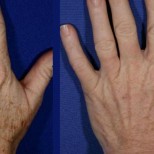 Подмладяване на ръцете: 5 домашни рецепти за премахване на бръчки
