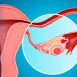 Кога вагиналното кървене може да е признак на рак