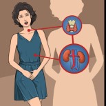 11 признака, че щитовидната ви жлеза не работи правилно и може да бъде опасно да ги игнорирате