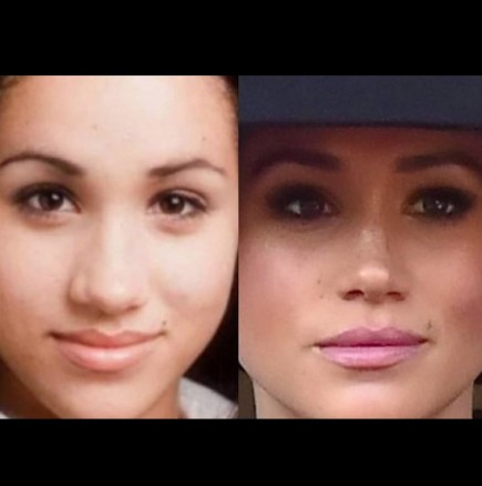 Тези снимки ПРЕДИ и СЛЕД на Меган Маркъл разкриха какви корекции е правила на лицето си (Снимки):