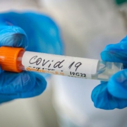 Драстичен спад на новите случаи на COVID-19 у нас