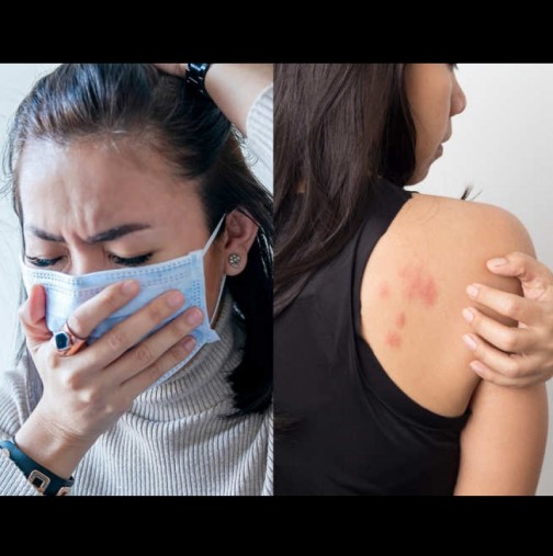 5 неприятни кожни симптома, които говорят, че сме пипнали COVID-19 (Снимки):
