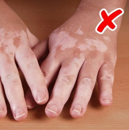 8 проблеми с кожата ви, на които обезателно трябва да обърнете внимание