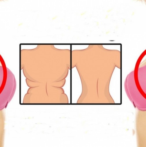 10 лесни начина да убиете мазнинките по гърба и паласките по кръста