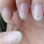 Какво да направите, за да възстановите ноктите си след гел лак?