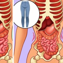 Ето защо не трябва да носите тесни панталони