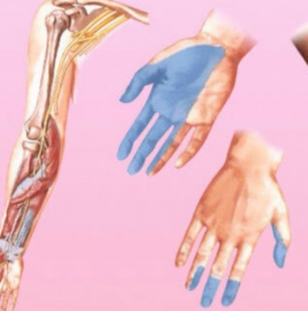 7 основни причини, поради които ръцете ви изтръпват
