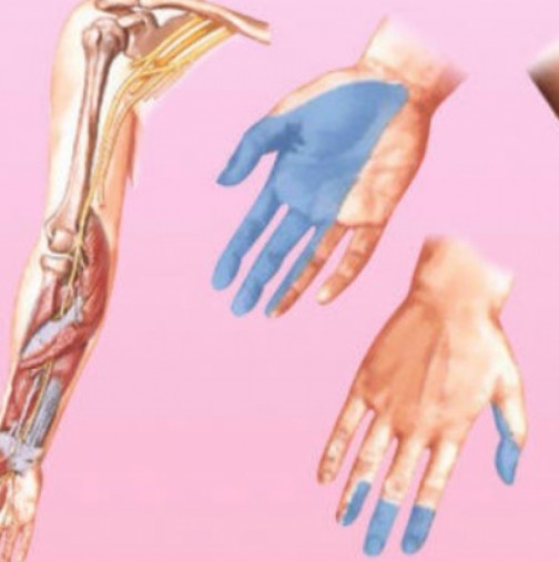 7 основни причини, поради които ръцете ви изтръпват