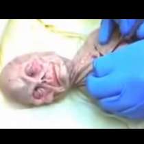 Вижте аутопсия на извънземно от 1969 година-видео