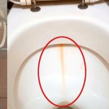 Как да се справим най- лесно с жълтите ивици в тоалетната