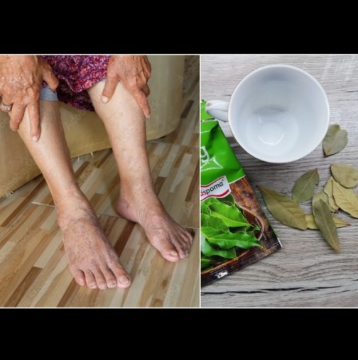 Домашна рецепта за болни крака и разширени вени от тефтерчето на баба: Запомнете я за цял живот!