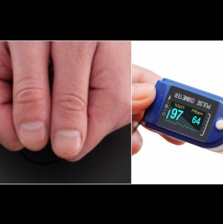 Тази особеност на ръцете издава недостиг на кислород в кръвта - ето как да разберете без пулсоксиметър: