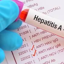 Мистериозен хепатит при децата в България-Ето симптомите -Започва масово тестване-Видео