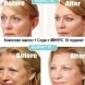 Кокосово масло + сода = 10 години по-младо лице! Ето колко е лесно: