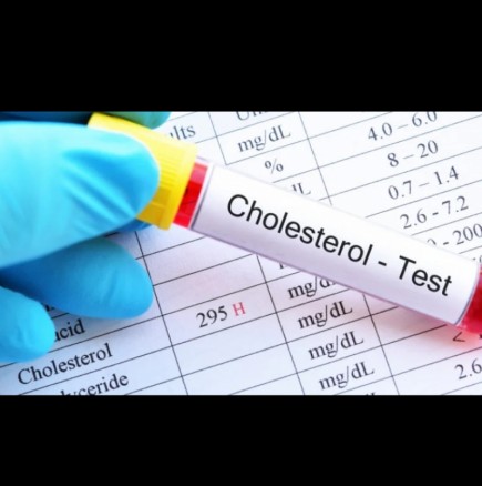 Ето как тялото ни сигнализира, че холестеролът ни е стигнал опасно високи нива: