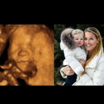 Бременна жена изгуби дъщеричката си си, но ултразвуковото изследване показа нещо невероятно (Видео): 
