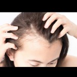 Скритата причина за загубата на коса: Набавете си този минерал и косата ще започне да расте отново!
