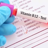ПРЕДУПРЕДИТЕЛНИТЕ признаци за дефицит на витамин B12, който може да доведе до необратими усложнения!