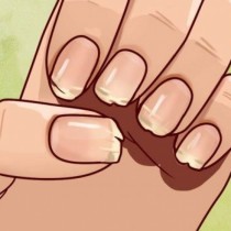 Ето какво се опитва да ви каже тялото ви, когато ноктите ви се белят и чупят