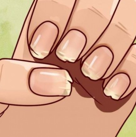 Ето какво се опитва да ви каже тялото ви, когато ноктите ви се белят и чупят