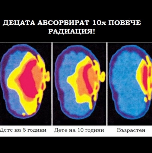 СЗО предупреждава: ето как да се предпазите от радиацията на мобилния телефон